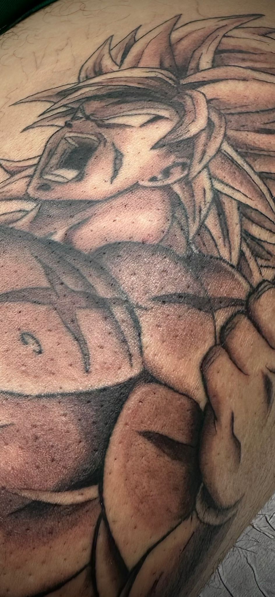 Detalhe 2